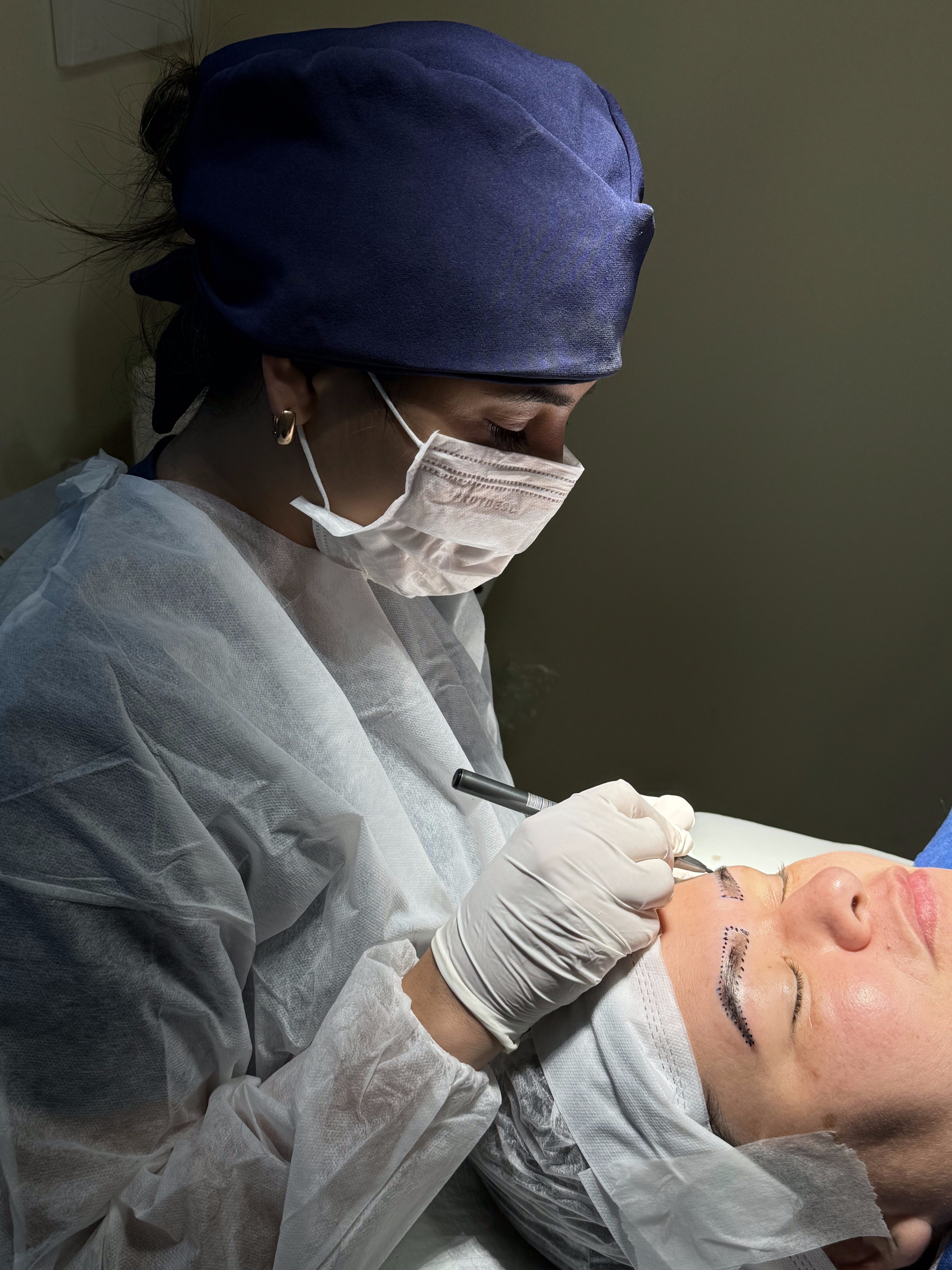 Transplante de Sobrancelhas dra gabriela pimentel